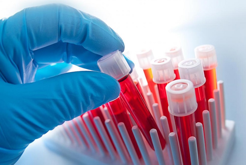 Analisis-Sangre-HCM.jpg
